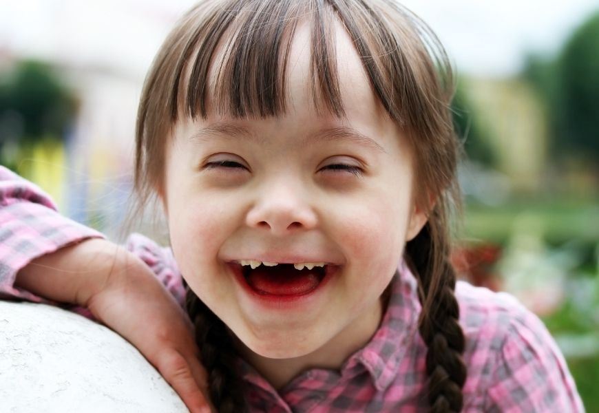 smiling child with Down Syndrome